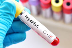 hepatite C